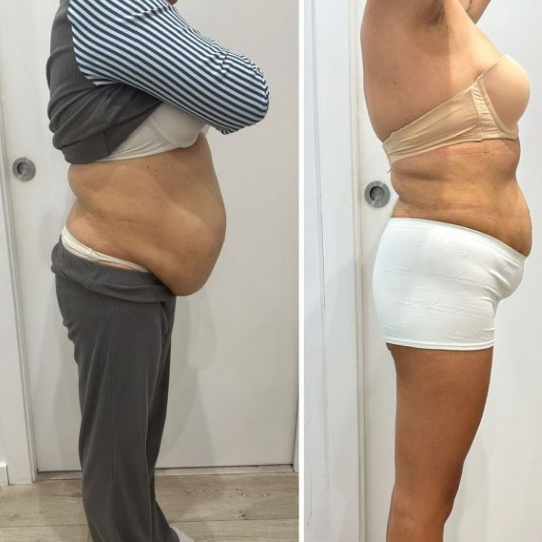 Transformación de Carolina